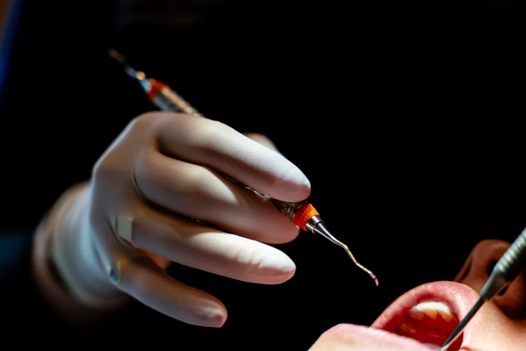 dentiste gisors soins gencives parodontologie dentiste gisors soins gencives parodontologie Soins de gencives Cabinet du château - Dr Simon KOENIG