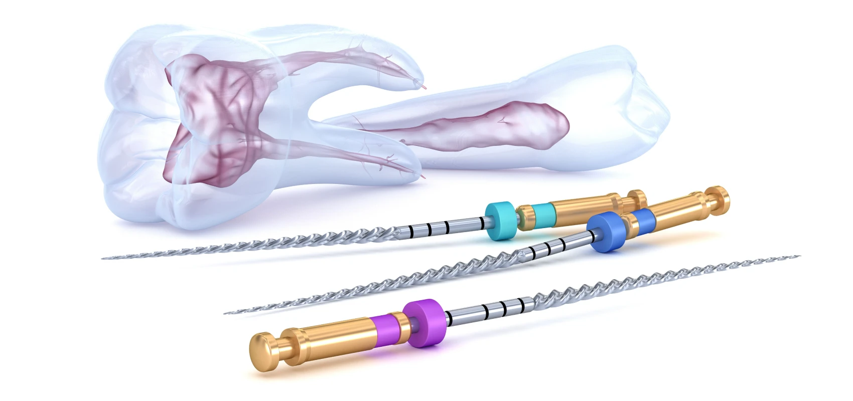 endodontie devitalisation Endodontie Cabinet du château - Dr Simon KOENIG