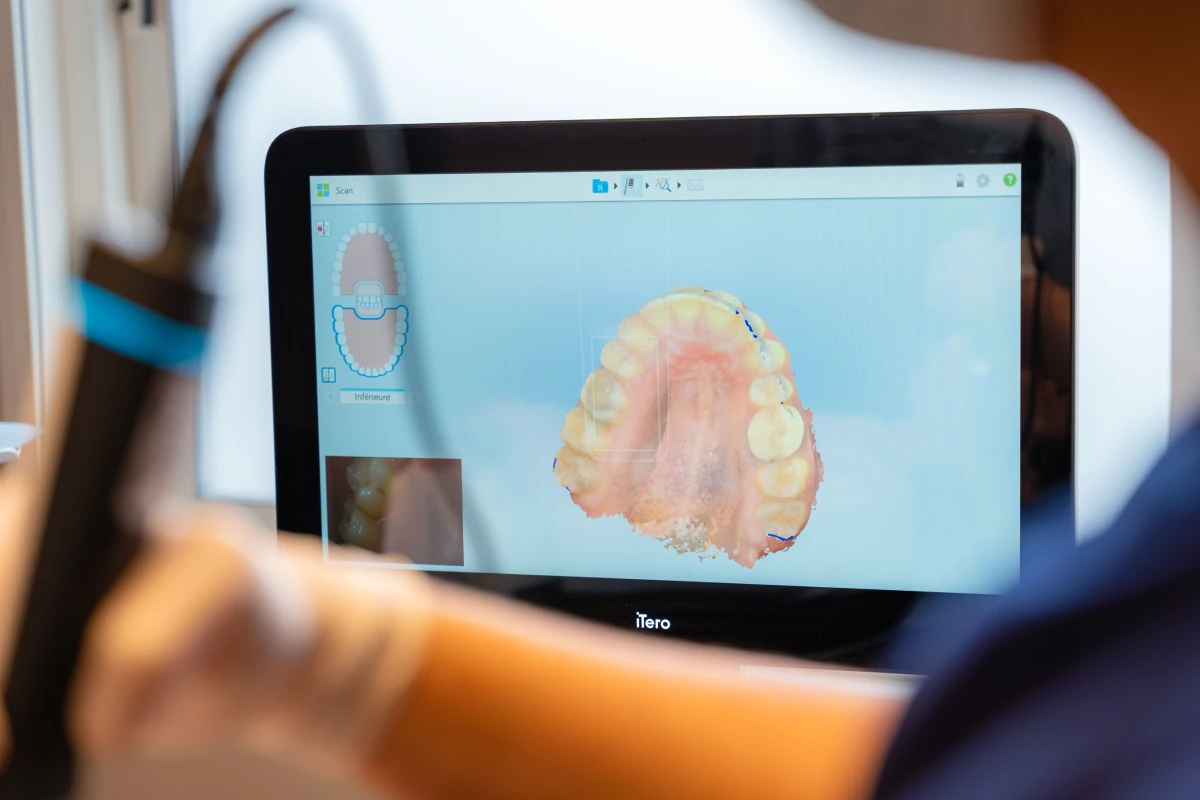 cone beam technologie dentaire dentiste gisors