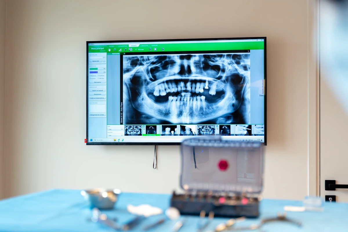 technologie planification dentaire dentiste gisors