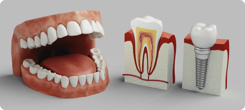dentiste implant dentaire meru dentiste implant dentaire meru Dentiste à Méru Cabinet du Château - Dr Simon KOENIG