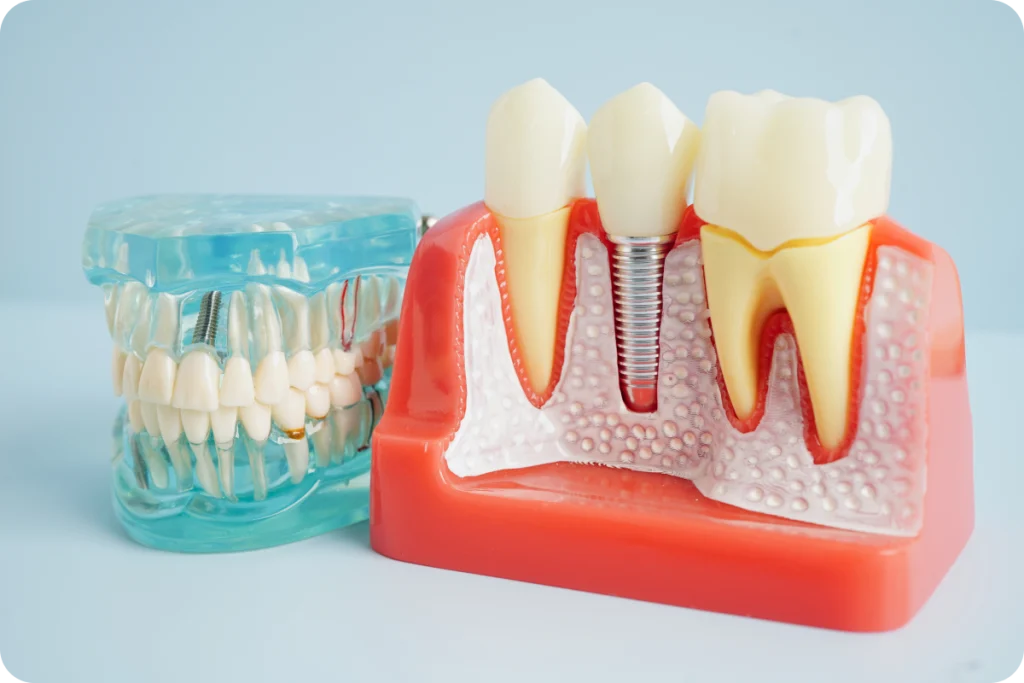 consultation dentiste gasny implant dentaire Dentiste à Gasny Cabinet du Château - Dr Simon KOENIG