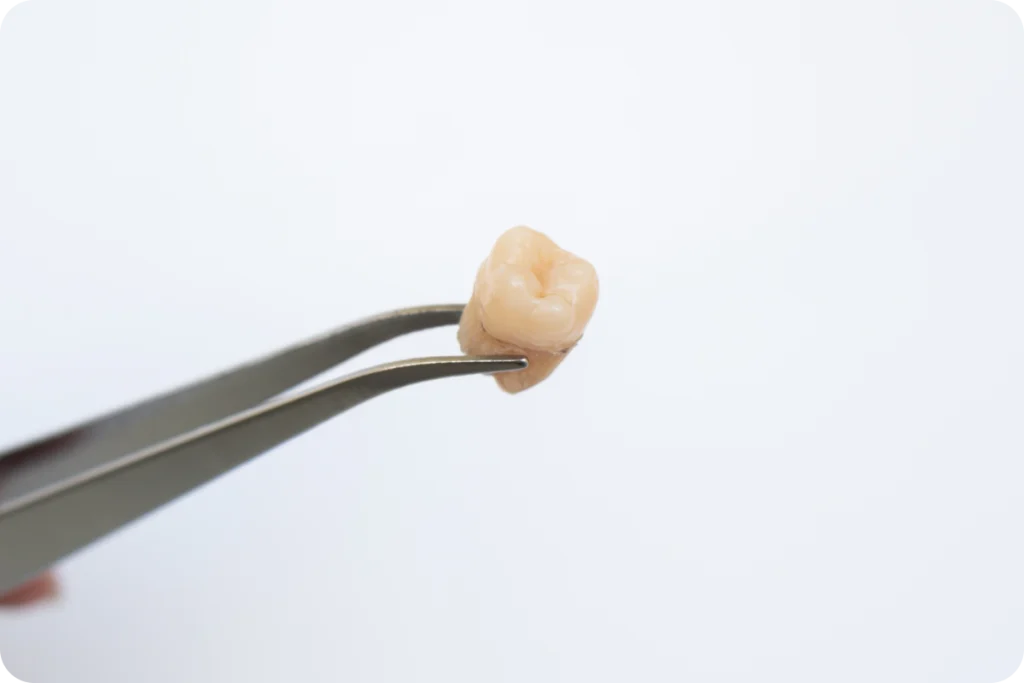 rdv dentiste forges les eaux implant dentaire Dentiste à Forge-les-Eaux Cabinet du Château - Dr Simon KOENIG